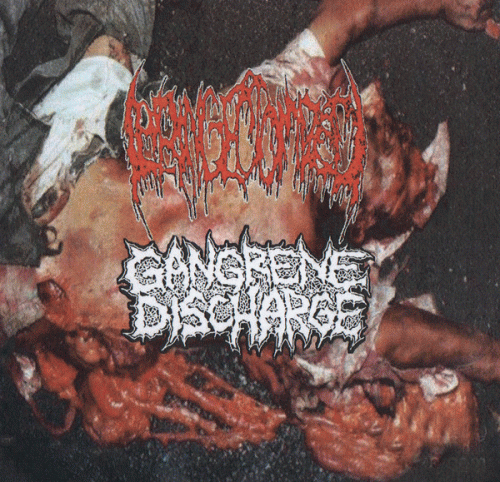 Gangrene Discharge : Laryngectomized - Gangrene Discharge